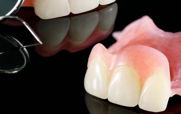 Image showing dental prosthetic isolatic partial denture upper side