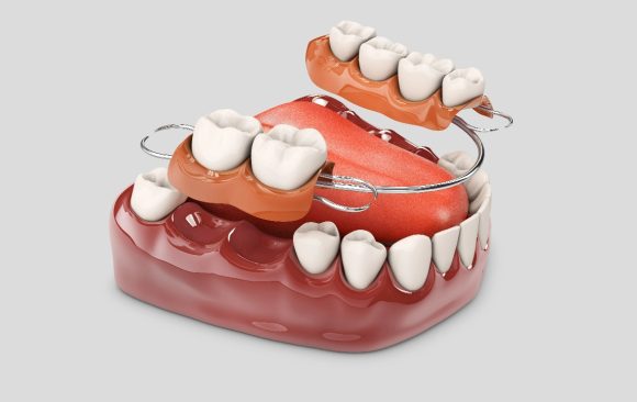Human teeth with denture 3d illustration showing isolated white teeth